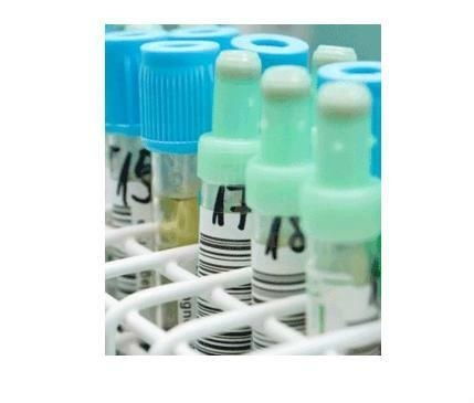 液體藥劑 非即飲型茶的創(chuàng)新應(yīng)用與市場(chǎng)前景